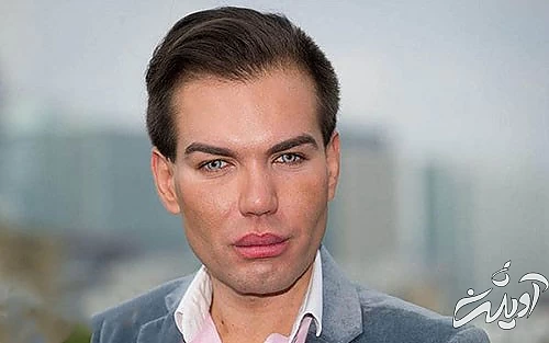 عجیبترین و مضحکترین جراحیهای زیبایی